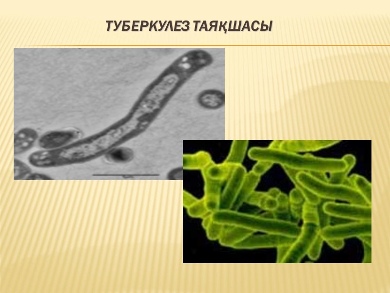 Туберкулез таяқшасы
